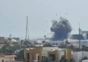 Израел: Хоспитализирани 960 луѓе во иранските напади, 150 на интензивна нега